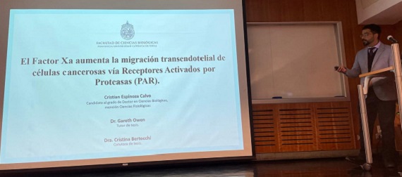 Cristian Espinoza defiende su tesis doctoral sobre el rol del Factor X activado en la progresión metastásica